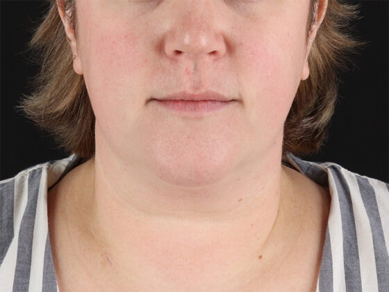 Case # 2 before photo