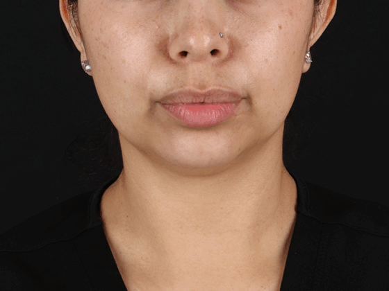 Case # 1 before photo