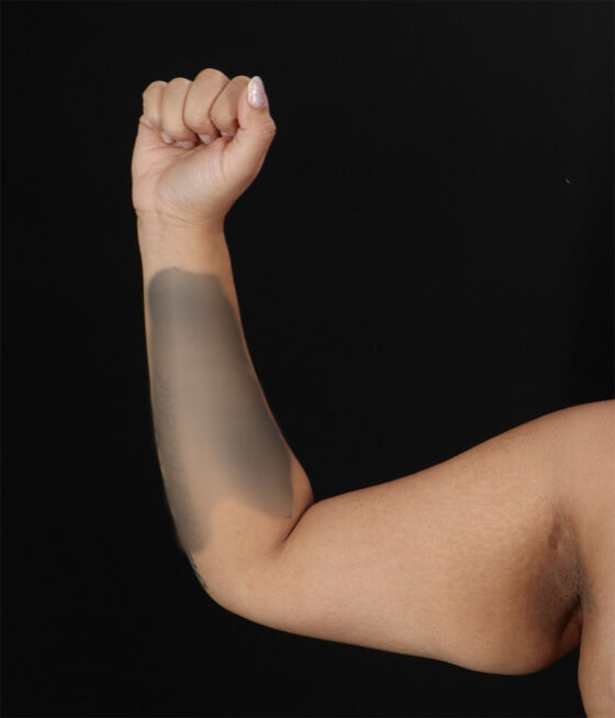 Case # 1 before photo