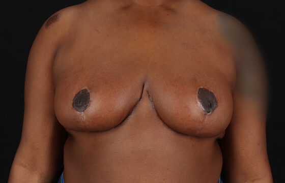 Case # 1 after photo